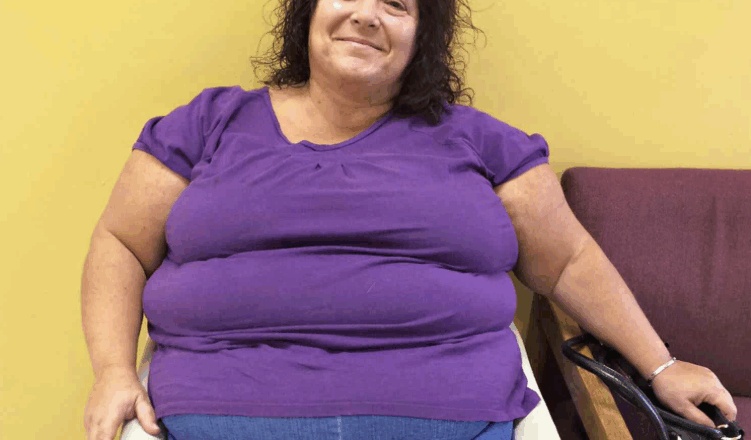 This Woman Lost Over 300 Pounds and Looks Totally Unrecognizable After… Photos Here!